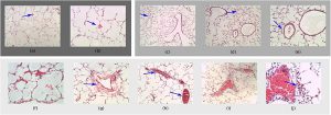 Hình 4. Hình ảnh đại diện về mô học phổi của một nghiên cứu thí nghiệm trên chuột kéo dài 3 giờ trong đó các đối tượng được chia ngẫu nhiên thành ba nhóm