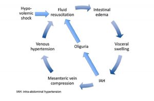 Hình 1: Vòng luẩn quẩn của hồi sức sốc nhiễm trùng. Adapted from Peeters et al. with permission [96]. IAH: intra-abdominal hypertension