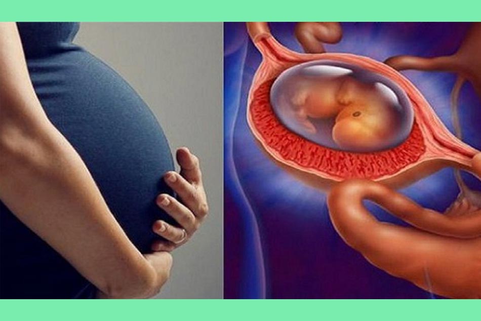 Hình ảnh thai ngoài tử cung