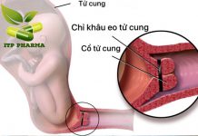 Khâu eo tử cung - Phương pháp giúp ngăn ngừa sinh non hiệu quả