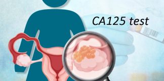 Các yếu tố liên quan đến tăng nồng độ CA125 trên bệnh nhân ung thư biểu mô buồng trứng tái phát tại Bệnh viện Từ Dũ