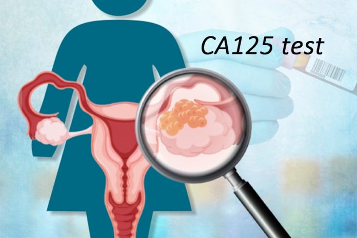Các yếu tố liên quan đến tăng nồng độ CA125 trên bệnh nhân ung thư biểu mô buồng trứng tái phát tại Bệnh viện Từ Dũ