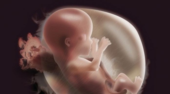 Thai chậm tăng trưởng trong tử cung: cập nhật chẩn đoán và xử tríThai chậm tăng trưởng trong tử cung: cập nhật chẩn đoán và xử trí