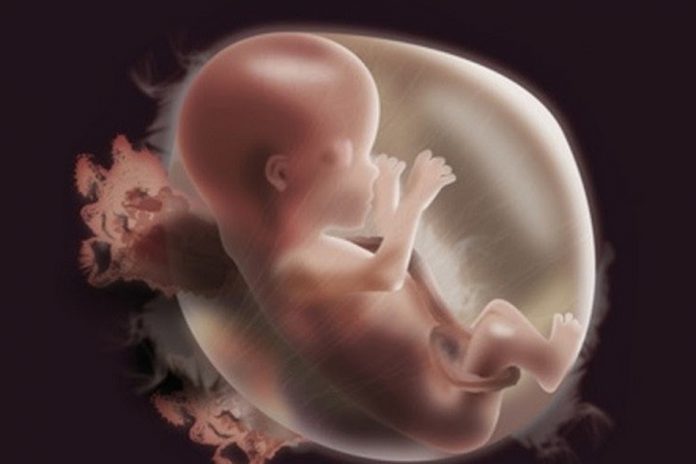 Thai chậm tăng trưởng trong tử cung: cập nhật chẩn đoán và xử tríThai chậm tăng trưởng trong tử cung: cập nhật chẩn đoán và xử trí