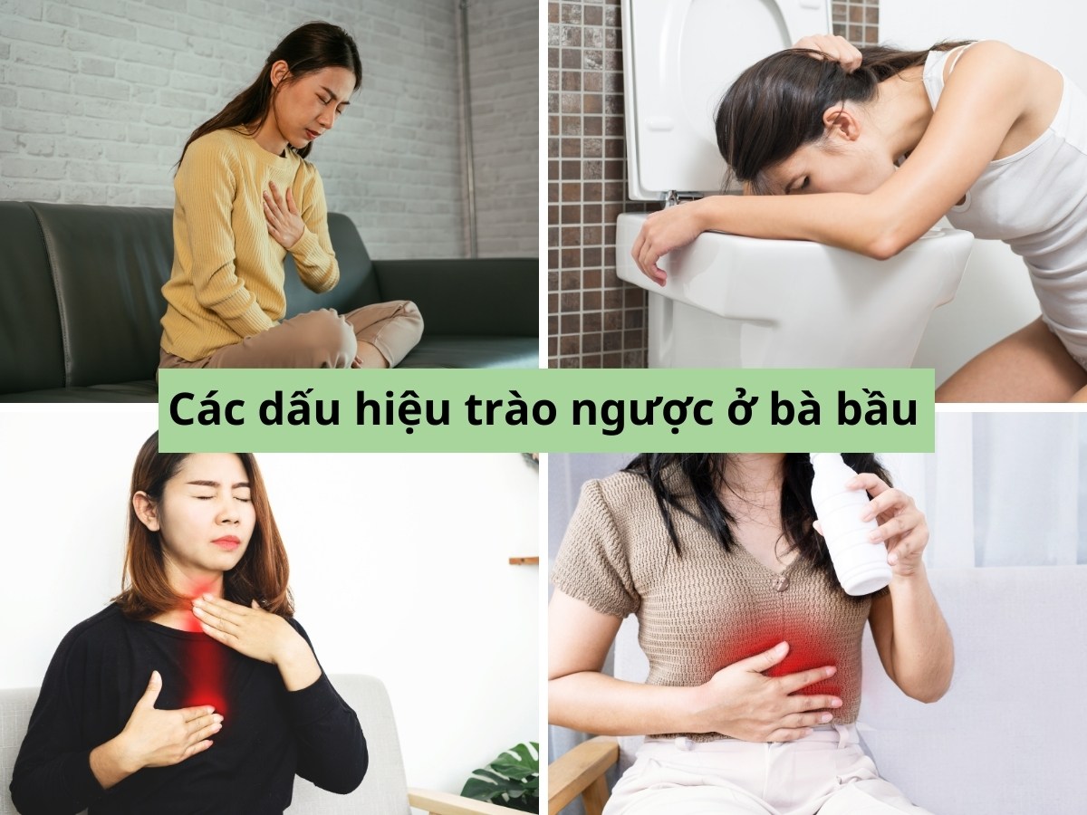 biểu hiện trào ngược dạ dày ở bà bầu