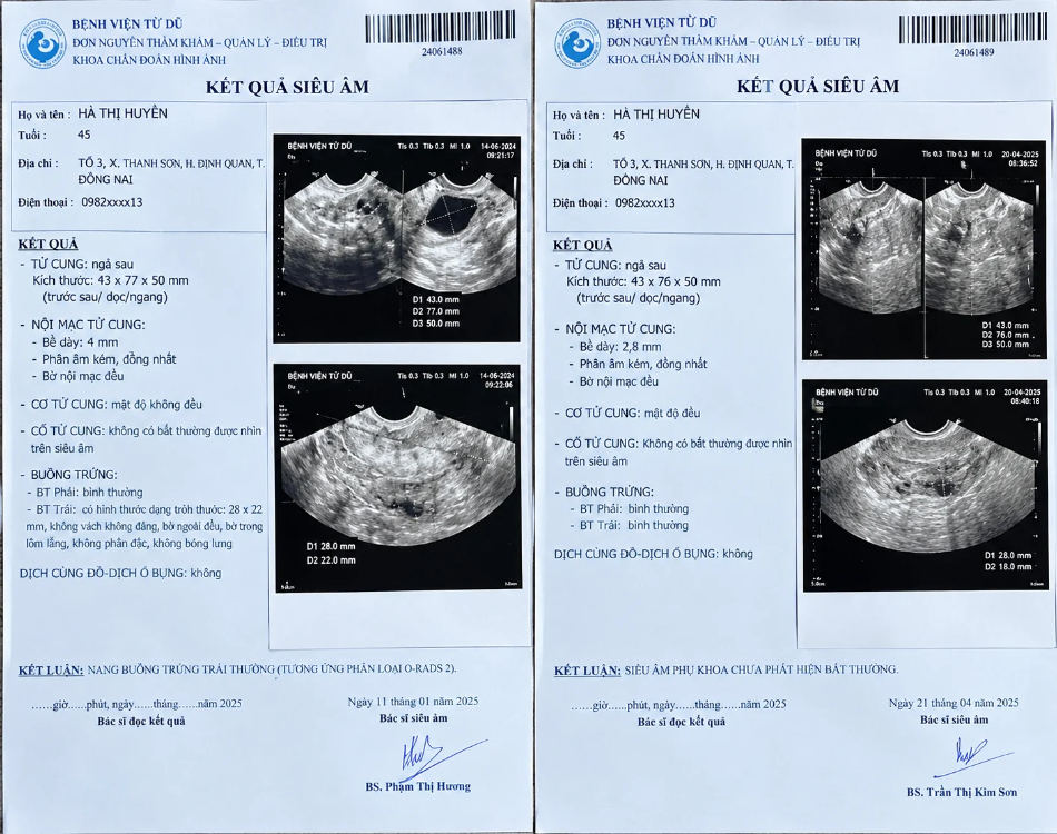 Kết quả siêu âm trước và sau khi sử dụng Cao Vị Nhân