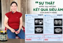 Sự thật đằng sau những kết quả siêu âm của khách hàng sử dụng Cao Vị Nhân Sự thật đằng sau những kết quả siêu âm của khách hàng sử dụng Cao Vị Nhân