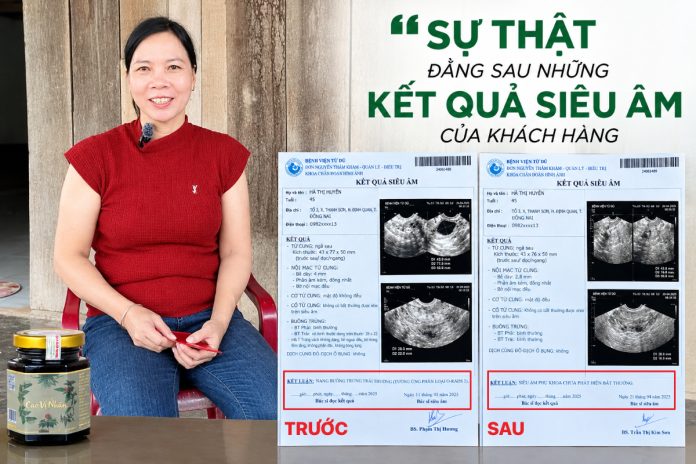 su-that-dang-sau-nhung-ket-qua-sieu-am-cua-khach-hang-su-dung-cao-vi-nhan Sự thật đằng sau những kết quả siêu âm của khách hàng sử dụng Cao Vị Nhân